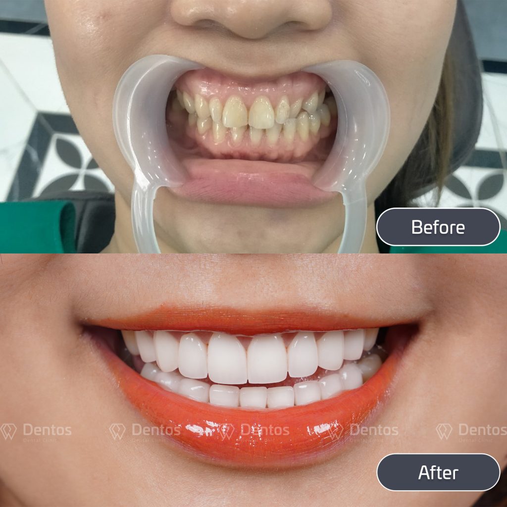 Dentos đem đến những trải nghiệm tuyệt vời nhất về thẩm mỹ và sức khỏe